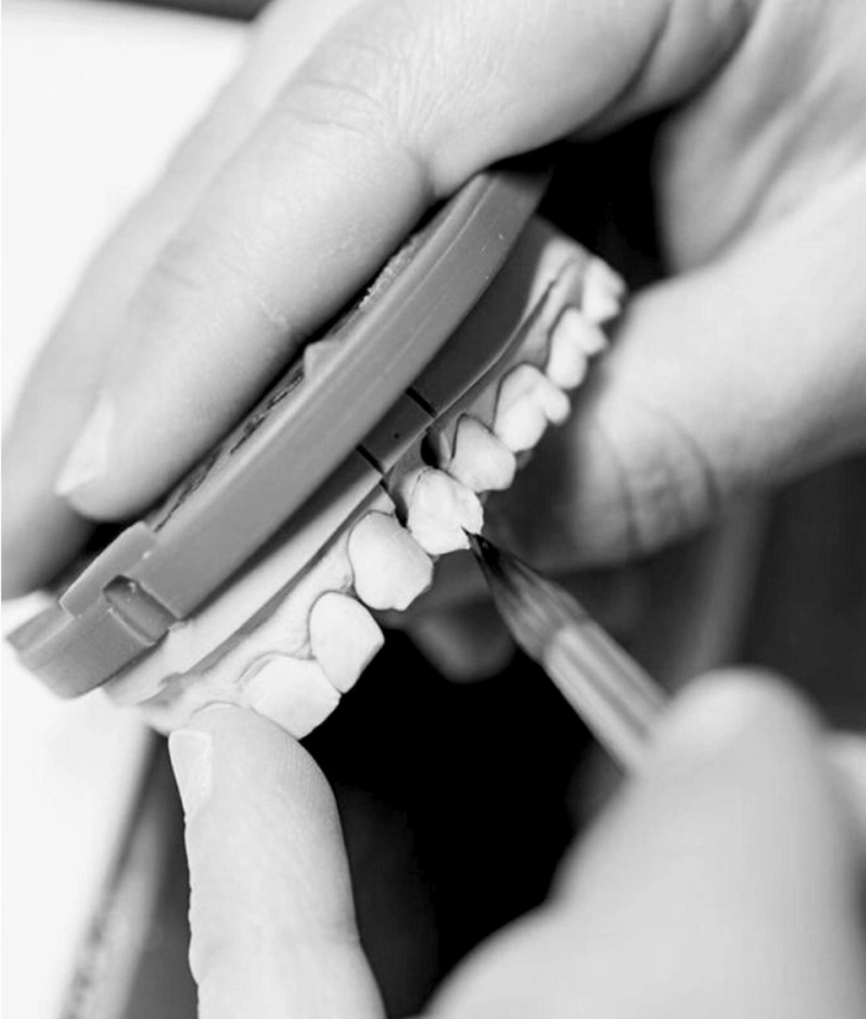 A close up of dental equipment